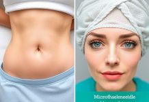 Три способа омоложения без скальпеля: Липолитики для живота, Безоперационная блефаропластика и Микроигольчатый RF-лифтинг Три способа омоложения без скальпеля: Липолитики для живота, Безоперационная блефаропластика и Микроигольчатый RF-лифтинг