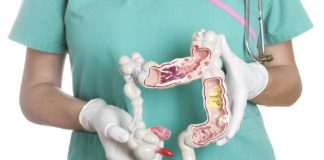 Аппендицит